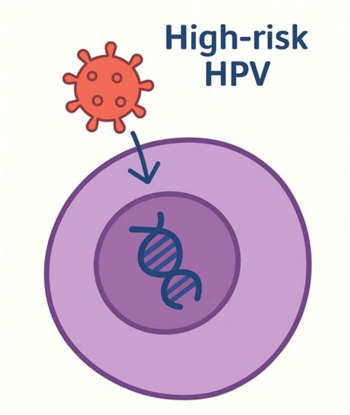 How do you get rid of high risk HPV naturally?