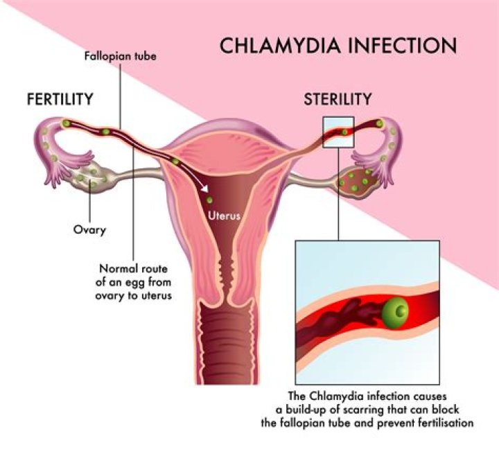 How do you know if chlamydia is gone after treatment?