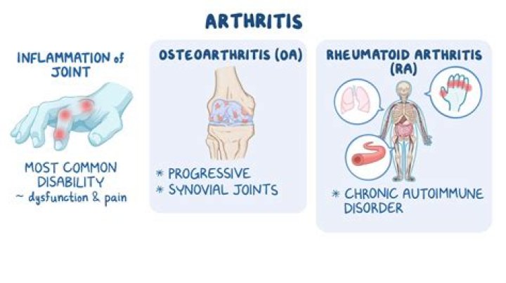 How do you slow down rheumatoid arthritis?