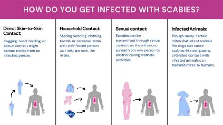 How do you tell if it's scabies or something else?