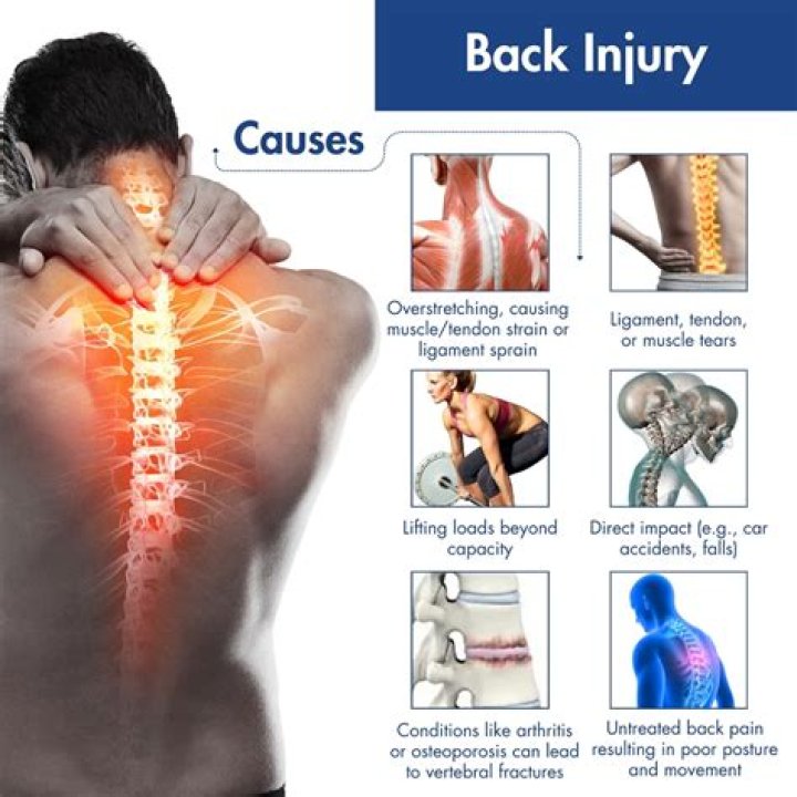 How long can you be out for a back injury?