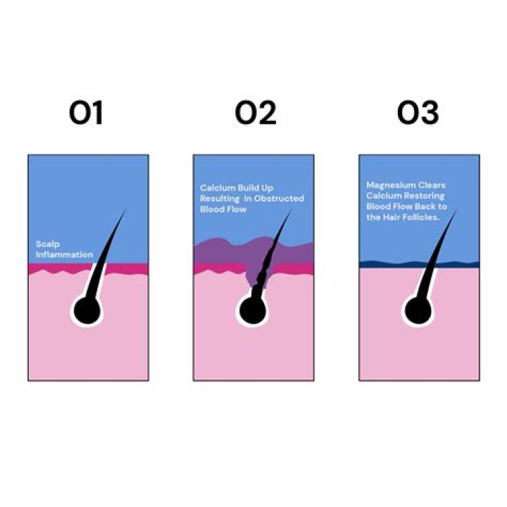 How much magnesium should I take for hair loss?