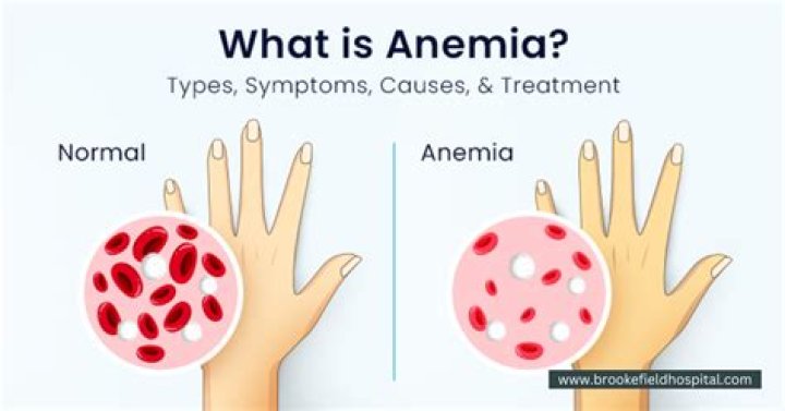 How serious is being anemic?