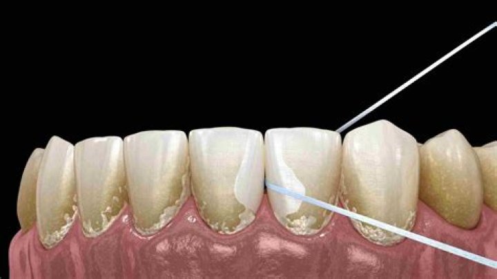Is it normal for floss to smell?