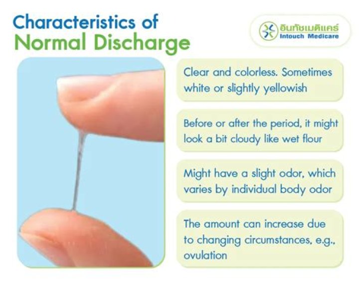 Is it normal to have discharge everyday?