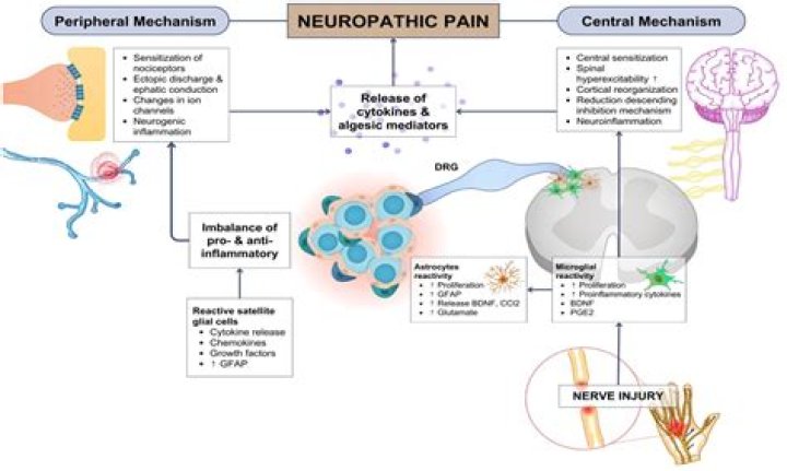 Is neuropathic pain real?