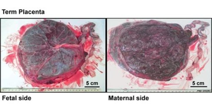 Is the placenta healthy to eat?