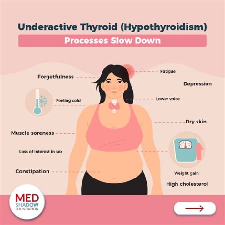 Is thyroid a lifelong condition?