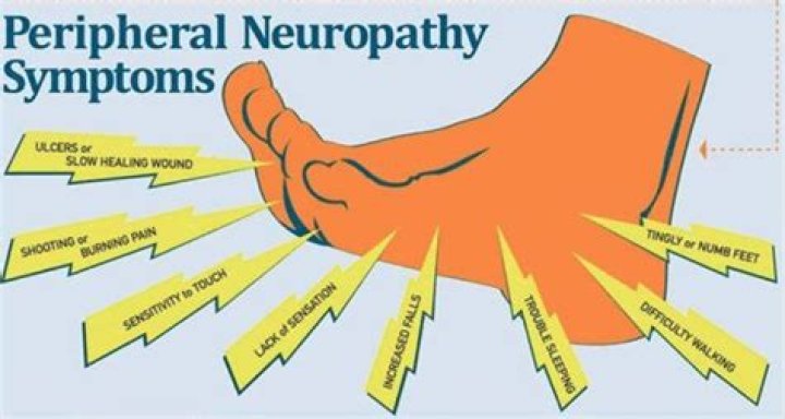 Is tinnitus a form of neuropathy?