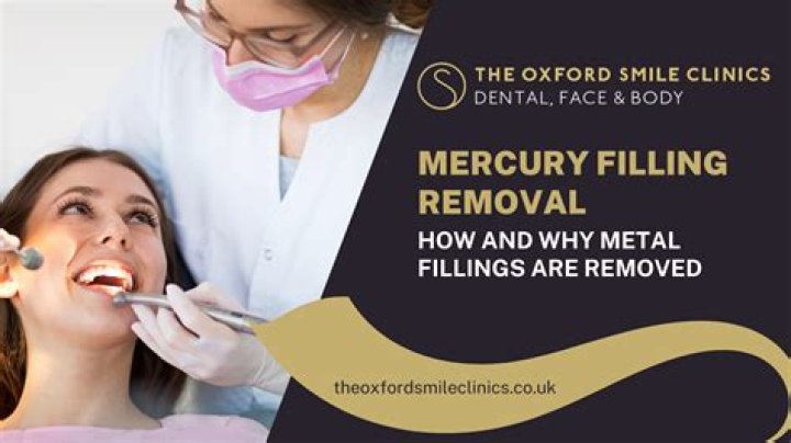 Should I get my mercury fillings removed?