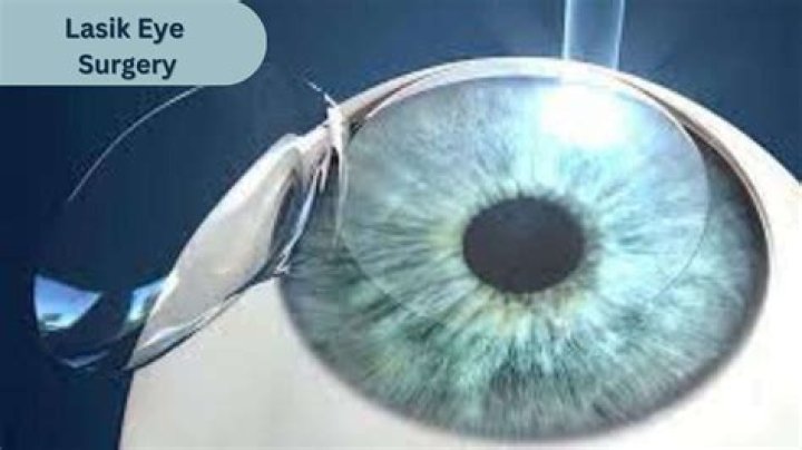 What are some disadvantages of LASIK surgery?