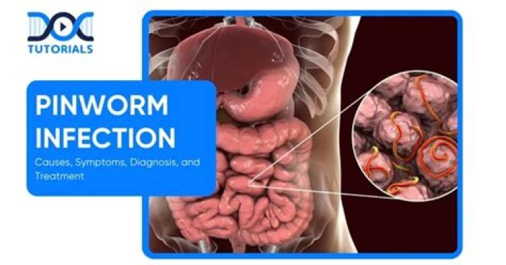 What are the symptoms of pinworm infection?