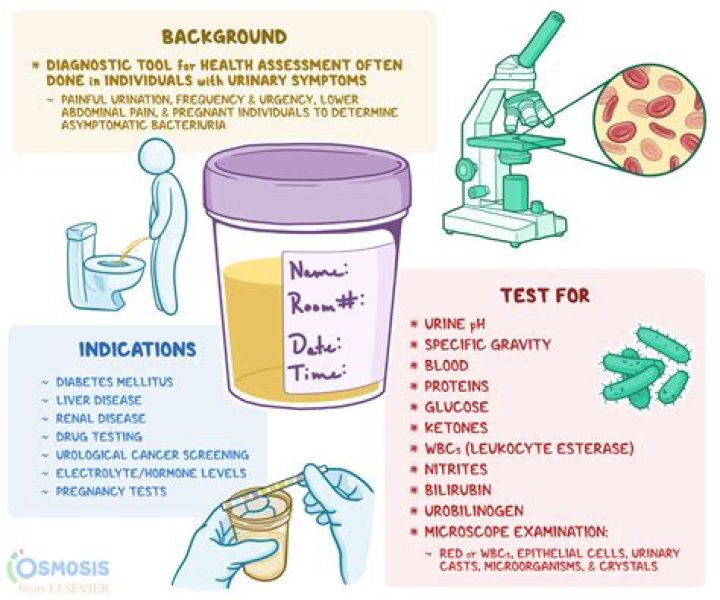 What can affect the results of a urine test?