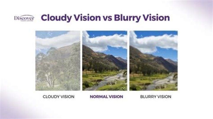 What causes hazy vision in one eye?