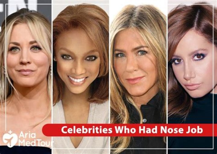 What celebrities have had nose jobs?