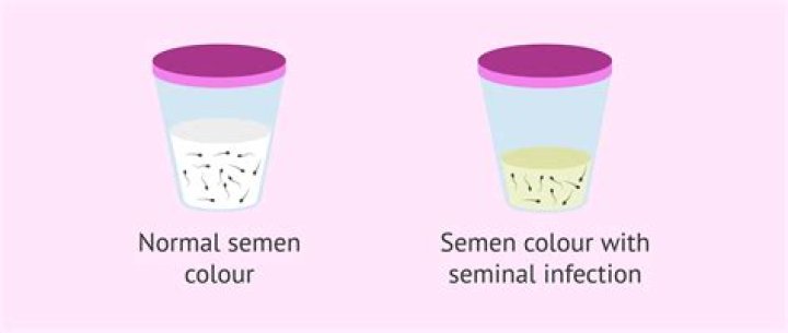 What color is sperm?