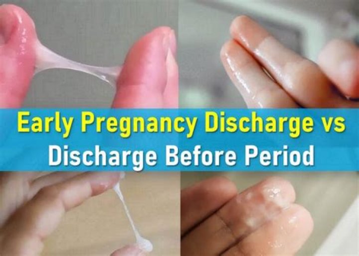 What discharge comes before pregnancy?