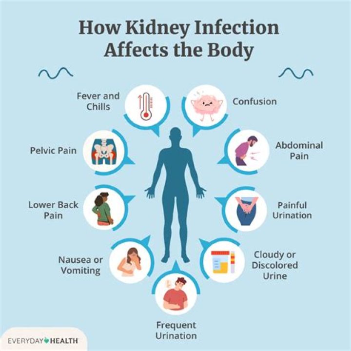 What does a kidney infection feel like in a woman?