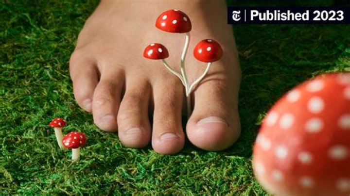 What does body fungus smell like?