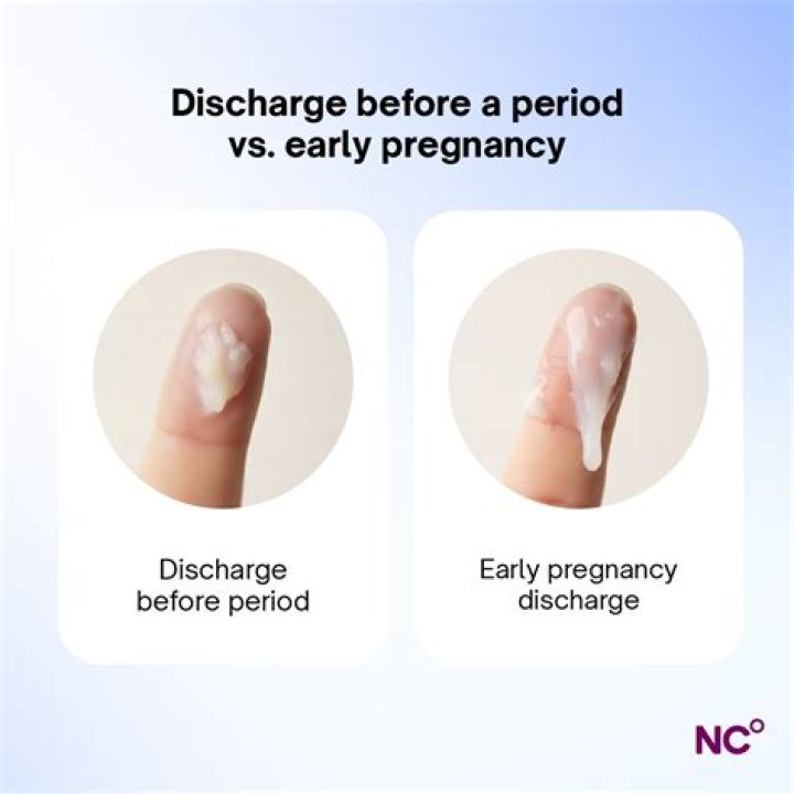 What does milky white discharge look like in early pregnancy?