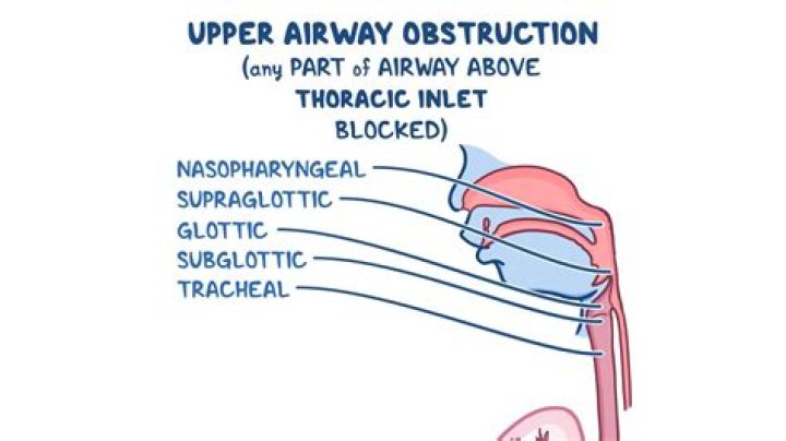 What happens when the airway is obstructed?