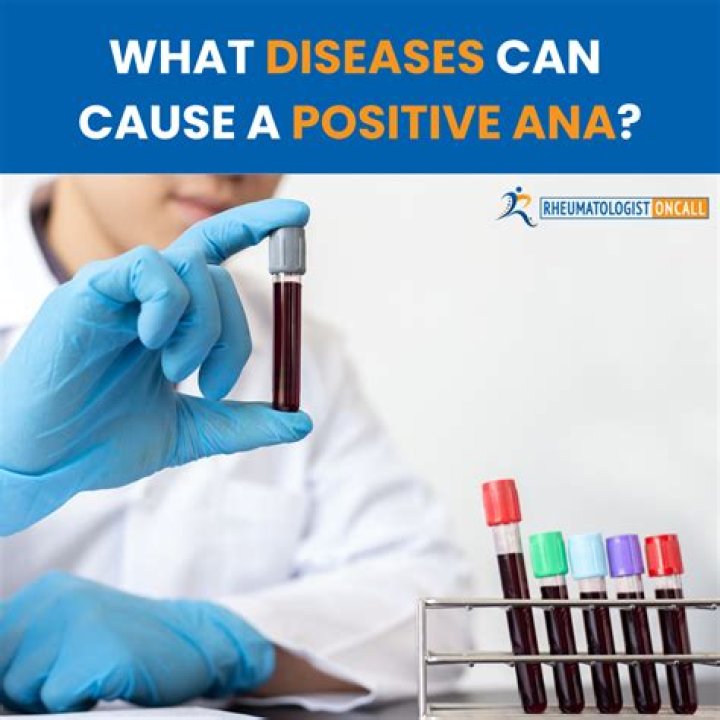 What infections can cause a positive ANA?