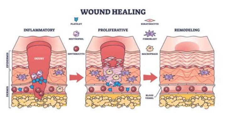 What is poor wound healing?