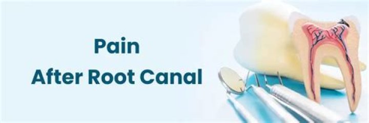 What is the best pain reliever after a root canal?