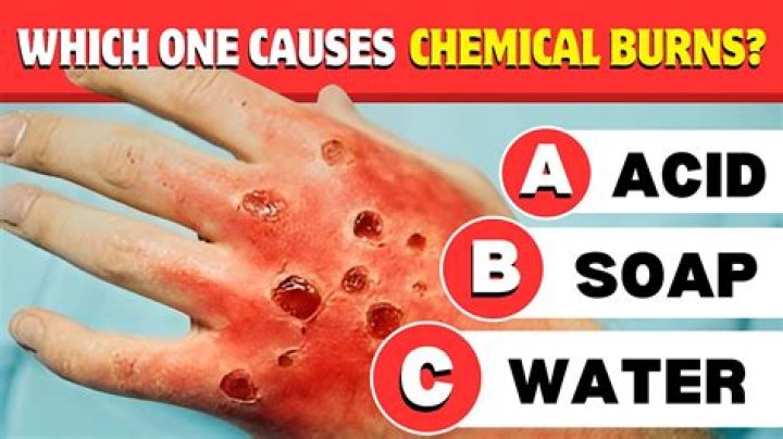 What is the chemical that causes love?