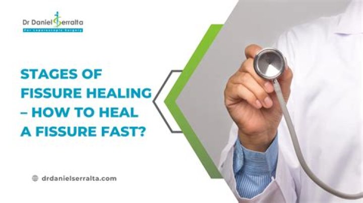 What is the fastest way to heal a chronic fissure?