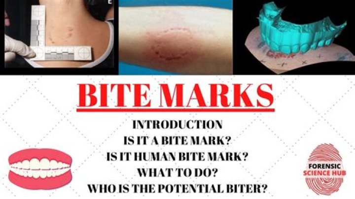 What is this bite mark?