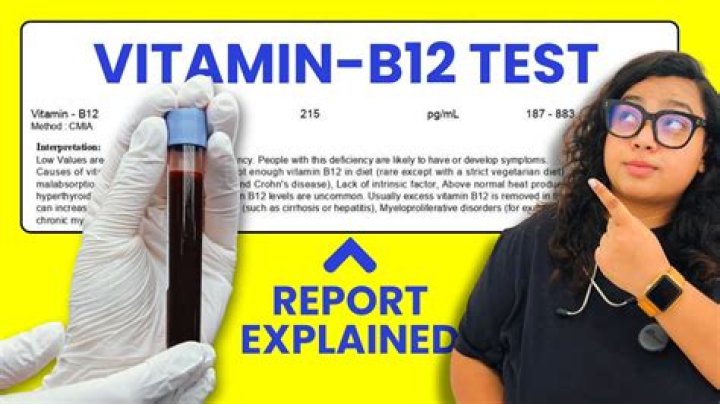 What should I not take B12 with?