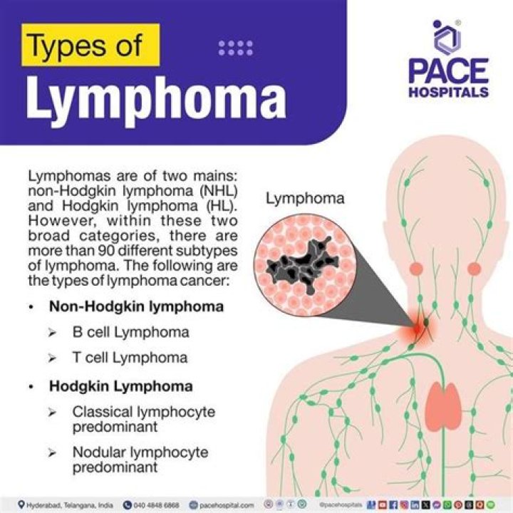 What's the difference between lymphoma and Hodgkin's lymphoma?