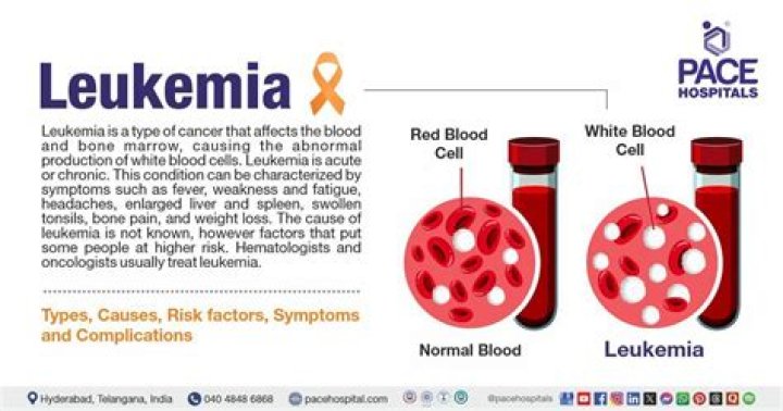 When do doctors suspect leukemia?