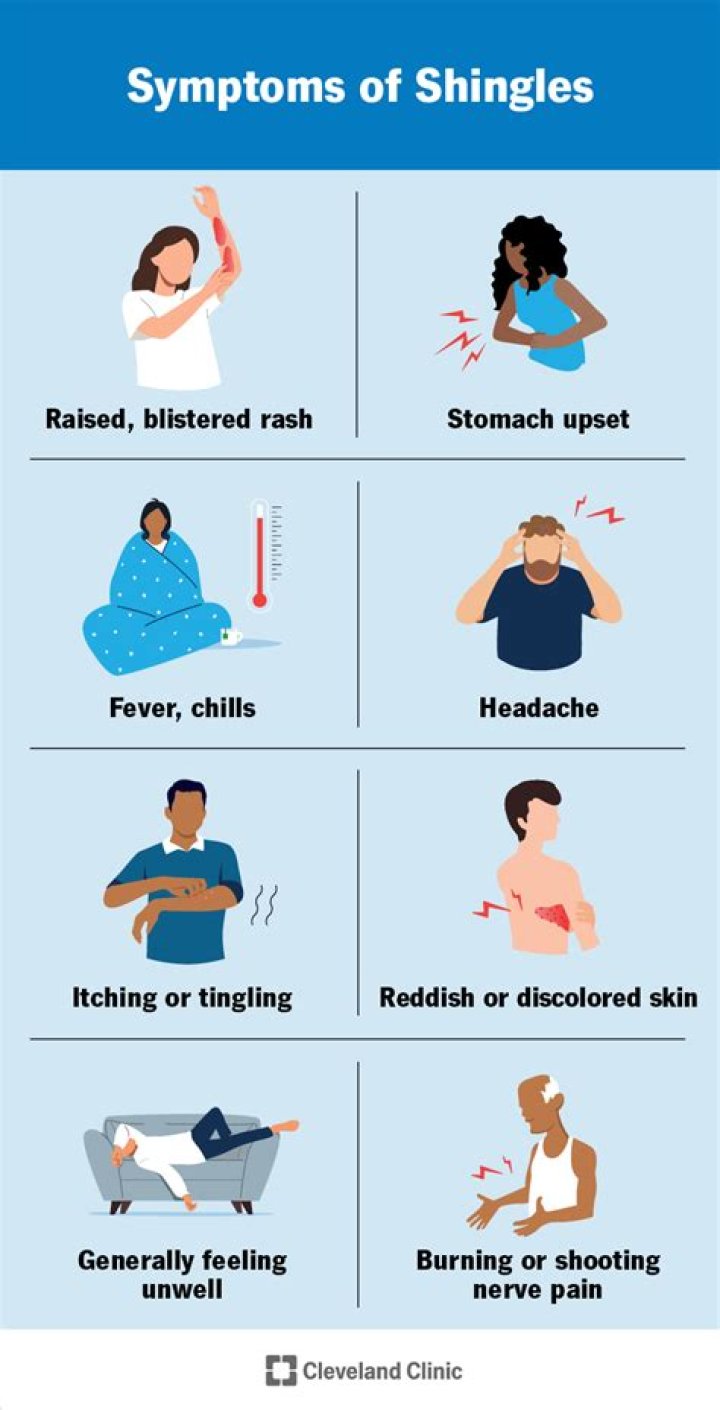 When do shingles symptoms peak?