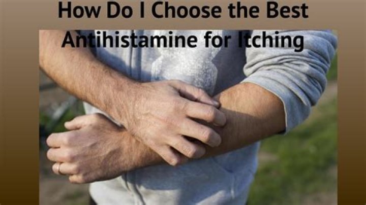 Which antihistamine is best for itching?