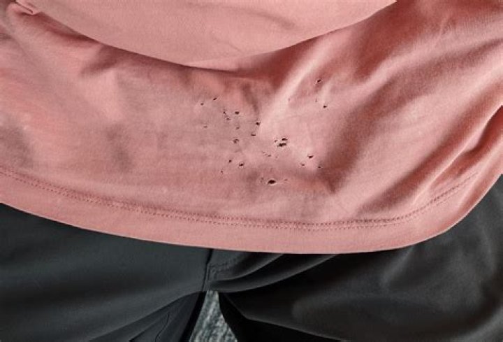 Why am I getting small holes in my clothes?