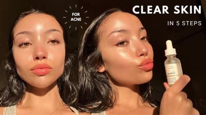 Why are models skin so clear?