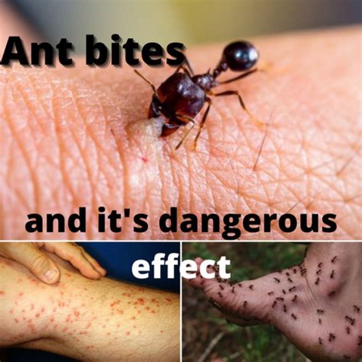 Why do red ants bite?