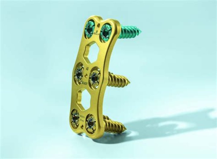 Why do titanium implants cost so much?