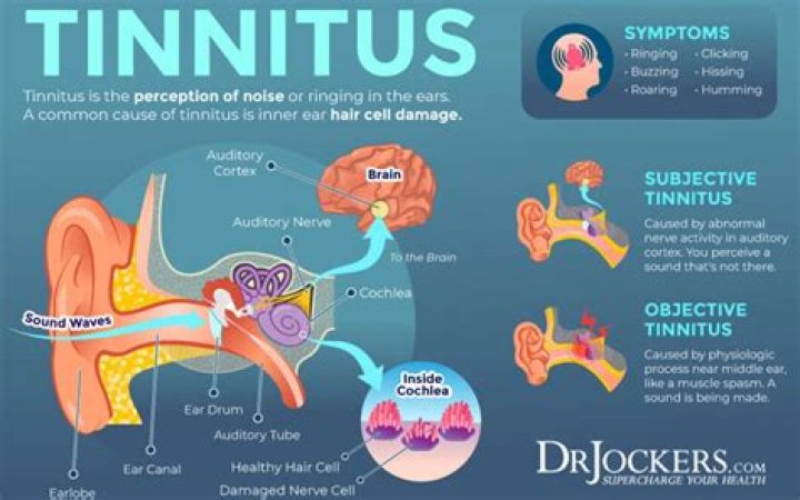 Why does tinnitus get worse when lying down?