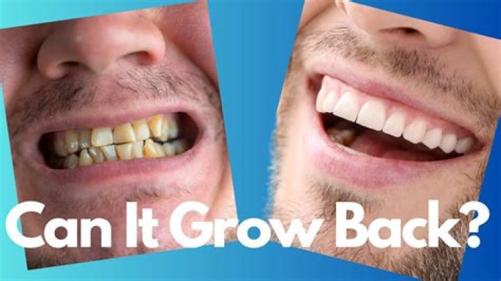 Why don t human teeth grow back?