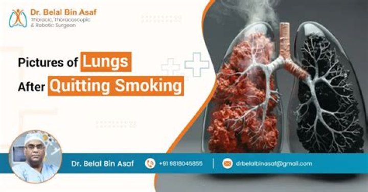 Why is breathing worse after quitting smoking?