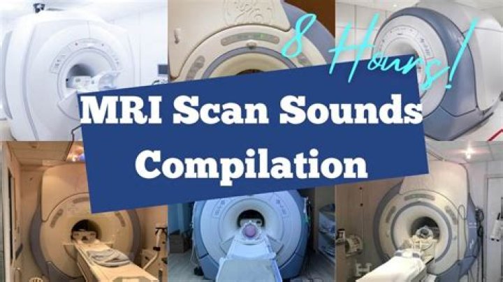 Why is MRI so noisy?