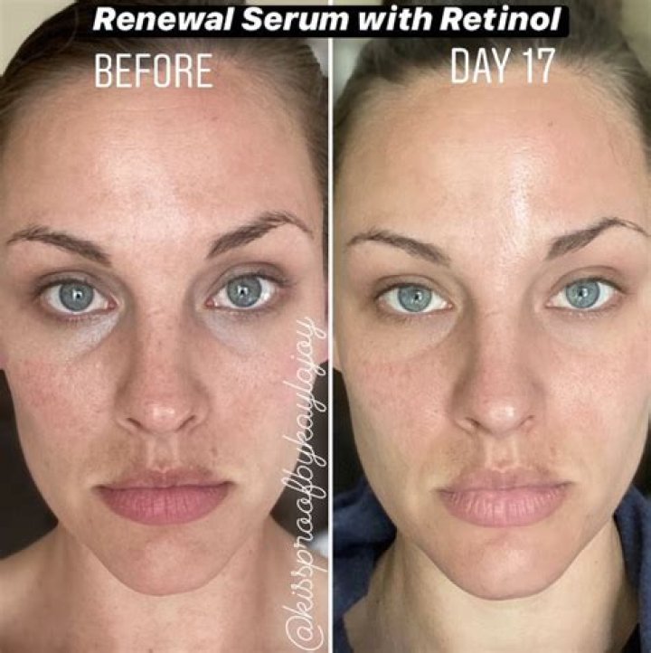 Why is my retinol not working?